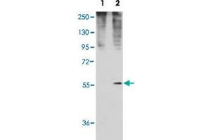 Western blot analysis of GDF11 (arrow) using rabbit GDF11 polyclonal antibody .
