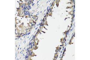 Immunohistochemistry of paraffin-embedded human prostate using OTC antibody (ABIN6003566) at dilution of 1/100 (40x lens). (OTC antibody)