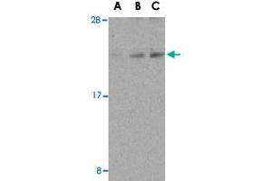 Western blot analysis of DAD1 in HepG2 cell lysate with DAD1 polyclonal antibody  at (A) 0.