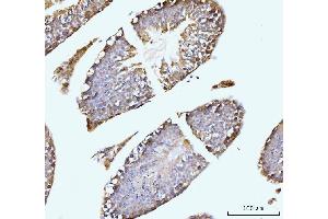 IHC analysis of GIT1 using anti-GIT1 antibody (ABIN7601683). (GIT1 antibody  (AA 415-736))