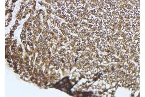 ABIN6274051 at 1/100 staining Mouse liver tissue by IHC-P. (TLR9 antibody  (Internal Region))