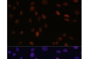 Immunofluorescence analysis of C6 cells using PSME3 Polyclonal Antibody at dilution of 1:100 (40x lens). (PSME3 antibody)