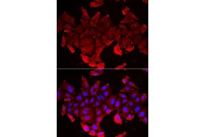 Immunofluorescence analysis of HeLa cell using SLC23A2 antibody. (SLC23A2 antibody)