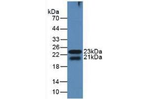 Western blot analysis of the recombinant protein. (LGALS8 antibody  (AA 151-316))
