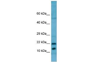 WB Suggested Anti-RPL11 AntibodyTitration: 1. (RPL11 antibody  (C-Term))