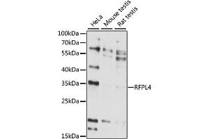 Western blot analysis of extracts of various cell lines, using RFPL4 antibody (ABIN7269924) at 1:1000 dilution. (RFPL4A antibody  (AA 1-100))