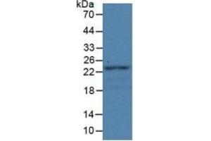Western Blotting (WB) image for Fibulin 1 (FBLN1) ELISA Kit (ABIN6574305)