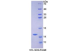 Image no. 1 for Solute Carrier Family 30 (Zinc Transporter), Member 5 (SLC30A5) (AA 639-751) protein (His tag) (ABIN4990577)