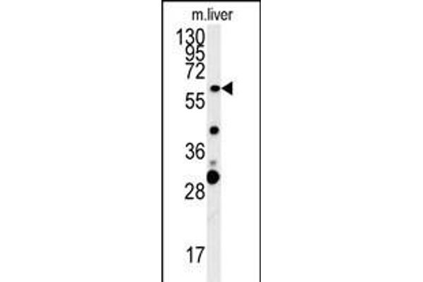 ZCCHC5 antibody  (N-Term)