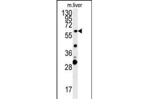 ZCCHC5 Antibody (N-term) (ABIN654002 and ABIN2843937) western blot analysis in mouse liver tissue lysates (15 μg/lane). (ZCCHC5 antibody  (N-Term))