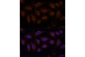 Immunofluorescence analysis of U-2 OS cells using PP2A Catalytic β antibody (ABIN3023492, ABIN3023493, ABIN3023494 and ABIN6220084) at dilution of 1:100. (PPP2CB antibody  (AA 1-309))