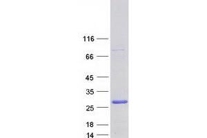 Validation with Western Blot (ING4 Protein (Transcript Variant 6) (Myc-DYKDDDDK Tag))