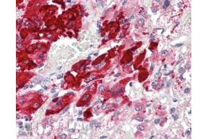 Immunohistochemistry (IHC) image for anti-Proopiomelanocortin (POMC) (C-Term) antibody (ABIN185387)