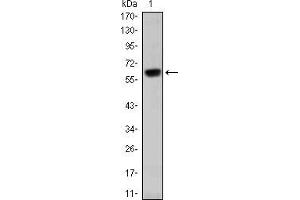 Western blot analysis using OTX2 mAb against human OTX2 (AA: 40-297) recombinant protein. (OTX2 antibody)