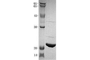 Western Blotting (WB) image for Interleukin 16 (IL16) (Transcript Variant 3) (Active) protein (ABIN2723625)