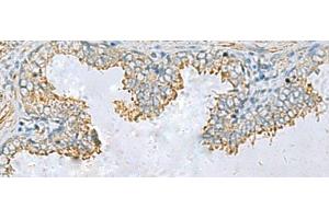 PLA2G15 antibody