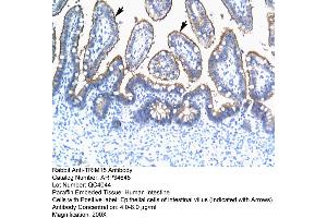 Human Intestine (TRIM15 antibody  (N-Term))