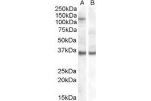 Western Blotting (WB) image for anti-Checkpoint Kinase 1 (CHEK1) (Middle Region) antibody (ABIN2791667) (CHEK1 antibody  (Middle Region))