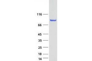 Validation with Western Blot