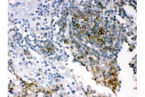 Immunohistochemistry (IHC) image for anti-SHC (Src Homology 2 Domain Containing) Transforming Protein 1 (SHC1) (AA 536-564), (C-Term) antibody (ABIN3043923)