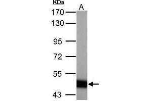 WB Image ABAT antibody detects ABAT protein by Western blot analysis. (ABAT antibody  (C-Term))