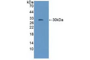 Detection of Recombinant NOS1AP, Mouse using Polyclonal Antibody to Nitric Oxide Synthase 1 Adaptor Protein (NOS1AP) (NOS1AP antibody  (AA 19-251))