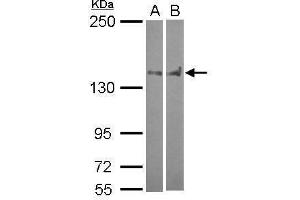 WB Image Sample (30 ug of whole cell lysate) A: A549 B: HCT116 5% SDS PAGE antibody diluted at 1:1000 (PTPN14 antibody  (C-Term))