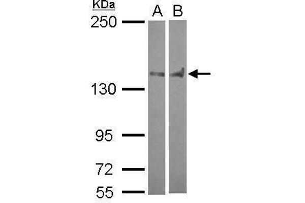 PTPN14 anticorps  (C-Term)