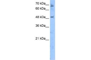 WB Suggested Anti-LENG4 Antibody Titration:  5. (MBOAT7 antibody  (C-Term))