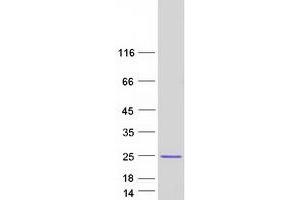 Validation with Western Blot (Cofilin 2 Protein (CFL2) (Transcript Variant 1) (Myc-DYKDDDDK Tag))