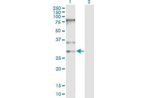 Western Blot analysis of SNRPB expression in transfected 293T cell line by SNRPB MaxPab polyclonal antibody. (SNRPB antibody  (AA 1-240))