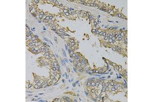 Immunohistochemistry of paraffin-embedded human prostate using EIF4B Antibody. (EIF4B antibody)