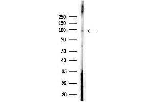 anti-NOP14 Nucleolar Protein (Nop14) (Internal Region) antibody