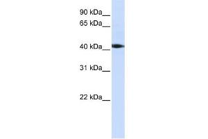 WB Suggested Anti-STK17A Antibody Titration:  0. (STK17A antibody  (C-Term))
