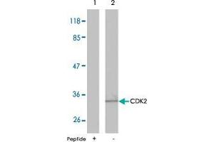 Western blot analysis of extracts from A2780 cells using CDK2 polyclonal antibody  .
