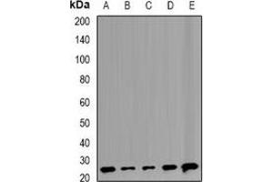 Western blot analysis of TMP21 expression in Raji (A), Hela (B), MCF7 (C), mouse liver (D), rat lung (E) whole cell lysates. (TMED10 antibody)