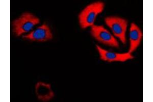 Immunofluorescent analysis of Carbonic Anhydrase 6 staining in H9C2 cells. (CA6 antibody  (C-Term))