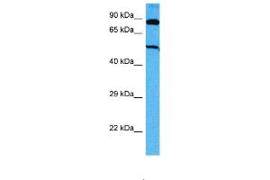 Host:  Mouse  Target Name:  SUFU  Sample Tissue:  Mouse Skeletal Muscle  Antibody Dilution:  1ug/ml (SUFUH antibody  (Middle Region))