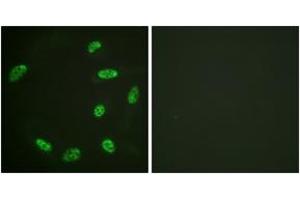 Immunofluorescence analysis of HeLa cells, using ERF (Ab-526) Antibody. (ERF antibody  (AA 492-541))