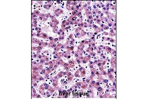 NNMT Antibody (Center) (ABIN657697 and ABIN2846688) immunohistochemistry analysis in formalin fixed and paraffin embedded human liver tissue followed by peroxidase conjugation of the secondary antibody and DAB staining. (NNMT antibody  (AA 101-130))