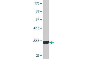 Western Blot detection against Immunogen (31. (PLP1 antibody  (AA 177-232))