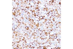 Immunohistochemistry (IHC) image for anti-Acetyl-CoA Acetyltransferase 1 (ACAT1) (AA 1-145) antibody (ABIN6136413)