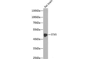Western blot analysis of extracts of Rat brain using STX5 Polyclonal Antibody at dilution of 1:1000. (Syntaxin 5 antibody)