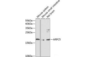 Western blot analysis of extracts of various cell lines using ARPC5 Polyclonal Antibody at dilution of 1:1000. (ARPC5 antibody)