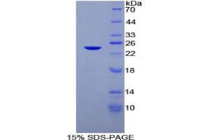SDS-PAGE analysis of Rat DISC1 Protein.