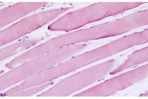 Human Skeletal Muscle: Formalin-Fixed, Paraffin-Embedded (FFPE) (MSH3 antibody  (AA 51-100))