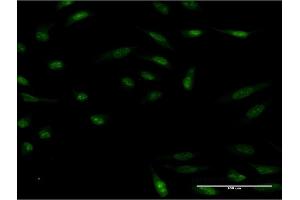 Immunofluorescence of monoclonal antibody to HMX2 on HeLa cell. (HMX2 antibody  (AA 125-224))