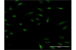 Immunofluorescence of monoclonal antibody to HMX2 on HeLa cell.