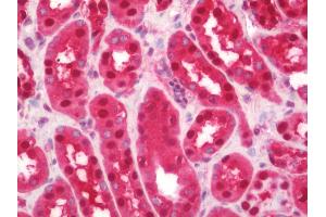 Human Kidney: Formalin-Fixed, Paraffin-Embedded (FFPE)