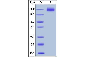 Human CEACAM-5, His Tag on  under reducing (R) condition. (CEACAM5 Protein (AA 35-685) (His tag))